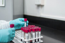 Το δεύτερο κρούσμα ευλογιάς των πιθήκων στην Ελλάδα είναι ένας 47χρονος ασθενής που ταξίδεψε πρόσφατα στην Ισπανία