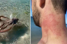 Αυστραλία: Το «πιο θυμωμένο χταπόδι» επιτίθεται σε τουρίστα 