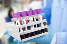 Τεστ αίματος