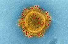 Η κλιματική αλλαγή επιδεινώνει πάνω από τις μισές μεταδοτικές ασθένειες στη Γη