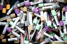 Εξετάσεις αίματος