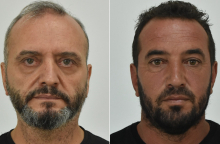 Ο 53χρονος Ηλίας Μίχος και ο 42χρονος Γιάννης Σοφιανίδης βιαστές της 12χρονης στον Κολωνό