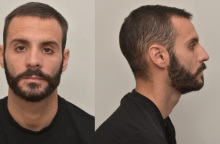 O 28χρονος κατηγορούμενος για τον βιασμό 4χρονου