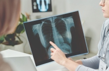 Καρκίνος του Πνεύμονα: Οι νέες θεραπευτικές προσεγγίσεις