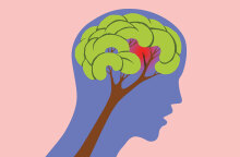 Μεθεόρτια εγκεφαλικού