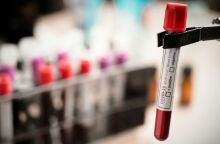 Έρευνα: Η λοίμωξη με Covid-19 διπλασιάζει τον μακροπρόθεσμο κίνδυνο καρδιακής προσβολής, εγκεφαλικού επεισοδίου και θανάτου.