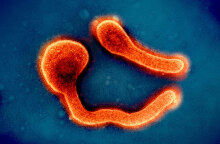 Ο γιατρός Γιώργος Παππάς μιλά για τον θανατηφόρο ιό Μάρμπουργκ