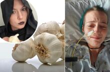 Μια γυναίκα στις ΗΠΑ ισχυρίζεται ότι πάσχει από μια σπάνια «ασθένεια των βαμπίρ» - Τι είναι η οξεία διαλείπουσα πορφυρία που συνδέεται με τον κόμη Δράκουλα.