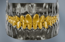 Τα λάθη που αλλοιώνουν το χρώμα των δοντιών μας 