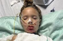 Επτάχρονη υπέστη εγκαύματα και μπήκε σε τεχνητό κώμα μετά από challenge στο TikTok