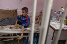 Υποσιτισμένο παιδί στη Γάζα