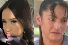 Επίθεση αγέλης σκύλων σε 17χρονη