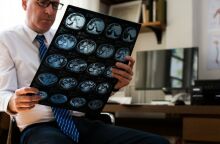 Μελέτη: Κράνος υπερήχων ανοίγει τον δρόμο για μη επεμβατική θεραπεία του Πάρκινσον - Πρωτοβουλία «ορόσημο για τις νευροεπιστήμες»