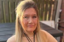 Ηνωμένο Βασίλειο: Η Έλεν ΜακΚλίρι, 46 ετών, έχασε τη μύτη της λόγω καρκίνου που αρχικά διαγνώστηκε λανθασμένα ως αλλεργία - Σήμερα ζει με προσθετική μύτη.