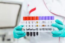 Βρετανοί επιστήμονες ανέπτυξαν την πρώτη ακριβή εξέταση αίματος για το σύνδρομο χρόνιας κόπωσης, προσφέροντας ελπίδα για έγκαιρη διάγνωση.