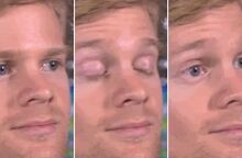 Ο Ντρου Σκάνλον, γνωστός από το meme «Blinking White Guy», συγκέντρωσε πάνω από 300.000 δολάρια για έρευνα κατά της σκλήρυνσης κατά πλάκας.