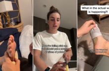 Χιλιάδες χρήστες βάζουν φέτες πατάτας στις κάλτσες πριν τον ύπνο πιστεύοντας ότι αποτοξινώνουν τον οργανισμό - Οι γιατροί διαψεύδουν τον «θαυματουργό» μύθο.