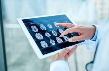 Μελέτη του Πανεπιστημίου Κέιμπριτζ: Ο εγκέφαλος μένει σε εφηβική φάση έως τα 32, με κρίσιμες αλλαγές στα 9, 32, 66 και 83 έτη.