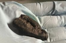 Αρχαίο DNA: Έφηβη μάσησε «τσίχλα» από φλοιό πριν από 10.500 χρόνια στην Εσθονία - Επιστήμονες ανέλυσαν ρητίνη σημύδας με αποτυπώματα δοντιών 