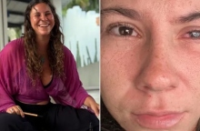 Η νεαρή μοιράστηκε την περιπέτεια με την απώλεια της όρασής της στα social media