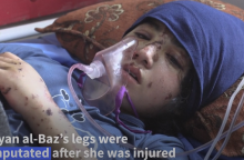 Η 13χρονη έχασε και τα δύο της πόδια μετά από βομβαρδισμό στη Γάζα