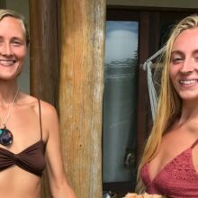 Μετά από 10 χρόνια χωρίς αποτρίχωση, ξυρίστηκαν πριν τον γάμο τους