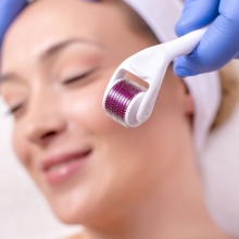 Derma Rolling: Λειτουργεί τελικά ή χαλάμε τζάμπα το δέρμα μας;