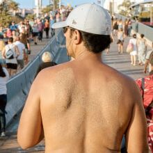 Γαλλία: Πρόστιμο έως 150 ευρώ στους τουρίστες που κυκλοφορούν χωρίς μπλούζα