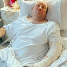 «Θα το ξαναέκανα»: Ο ήρωας του Σίδνεϊ κινδυνεύει να χάσει το χέρι του