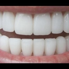How To Have Natural White Teeth in 3 minutes ( Works 100% )