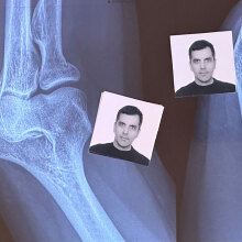 Φωτογραφίες ταυτότητας πάνω σε ακτινογραφία