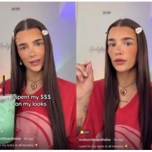 Η influencer έδωσε στη δημοσιότητα τον αναλυτικό λογαριασμό των πλαστικών επεμβάσεων που έχει κάνει 