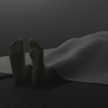 Ενέσεις λίπους από πτωματικούς δότες - Η νέα «λύση» στο body shaping που διχάζει