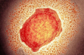 Ιός της ευλογιάς των πιθήκων 