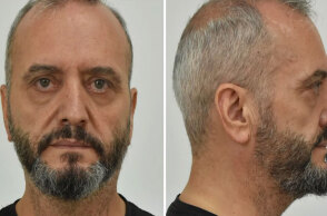 Ο 53χρονος στον Κολωνό που βίαζε και εξέδιδε τη 12χρονη μαθήτρια