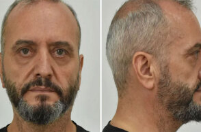 Ο 53χρονος στον Κολωνό που βίαζε και εξέδιδε τη 12χρονη μαθήτρια