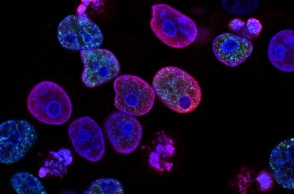 Νέα θεραπεία «άλμα προς τα εμπρός» στην προσαρμοσμένη ιατρική για τον καρκίνο