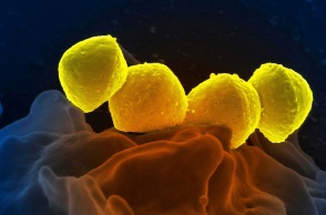 Ανησυχία για στρεπτόκοκκο Α σε σχολεία της Βρετανίας - Έξι παιδιά νεκρά