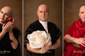 100 καλλιτέχνες φωτογραφίζονται χωρίς μαλλιά για καλό σκοπό