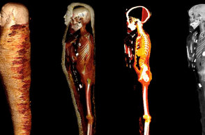 Η μούμια «Golden Boy» στην Αίγυπτο εξετάστηκε με τη βοήθεια αξονικού τομογράφου