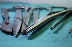 14χρονη στη Θεσσαλονίκη πέθανε μετά το χειρουργείο για την τοποθέτηση γαστρικού δακτυλίου