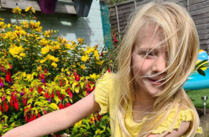 Η 6χρονη Caitlin Hutson στη Βρετανία που έχει ανάγκη το βιονικό χέρι