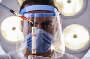 Κορωνοϊός: Ερευνητές αναπτύσσουν τεστ Covid για όλα τα είδη ζώων