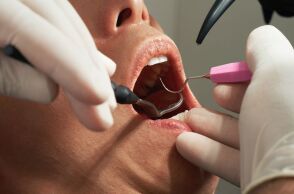 ΗΠΑ: Γυναίκα μηνύει οδοντίατρο για 4 απονευρώσεις, 8 θήκες και 20 σφραγίσματα σε ένα ραντεβού