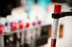 Μαγιορκίνης για κορονοϊό: Έως τέλος Ιανουαρίου η κορύφωση της έξαρσης της Covid-19 - Έχει υποτιμηθεί το ενισχυμένο εμβόλιο