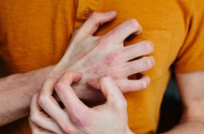 Κόκκινα σημάδια στο δέρμα: Η προειδοποίηση των γιατρών 