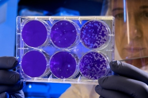 επιστημονας κραταει δοχεια με βακτηρια