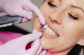 Όψεις πορσελάνης