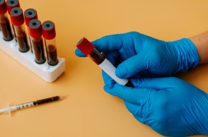 χερι, γαντια, φυαλιδια, αιμα