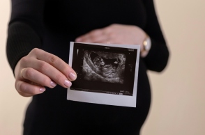 εγκυος, υπερηχογραφημα